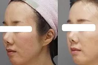 stem cells treatment in China